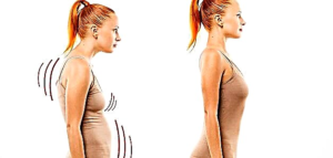 Servikal osteokondroz